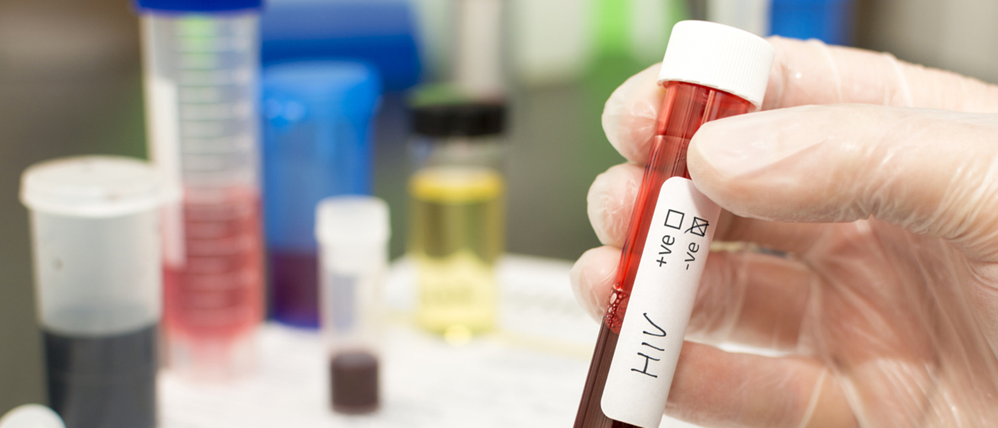 HIV and Medicaid