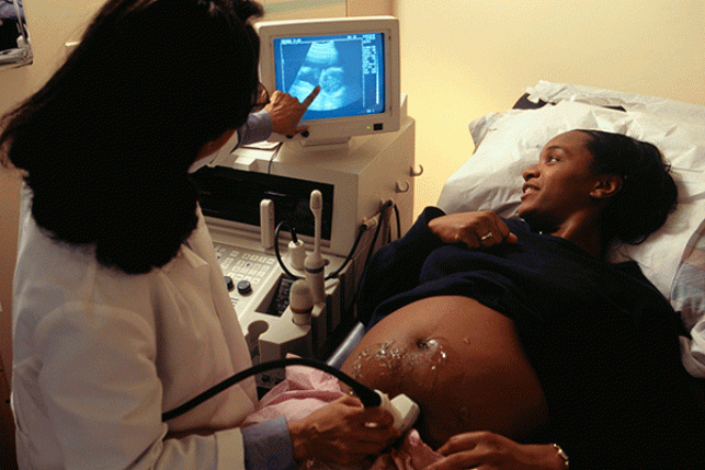 woman getting ultrasound while pregnant