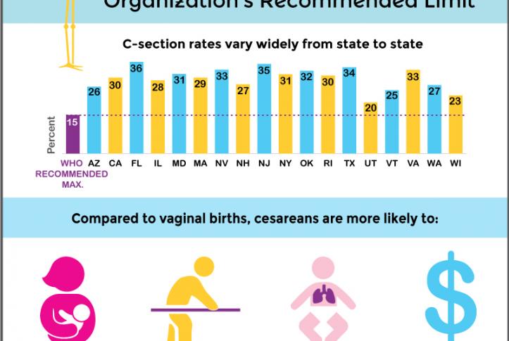 Cesarean Birth Rates in US