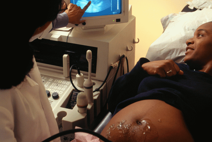 woman getting ultrasound while pregnant