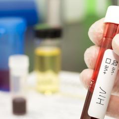 HIV and Medicaid
