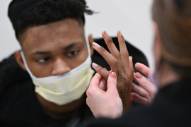 Black teen receiving physical therapy on his hand as part of recovery from gunshot wounds.